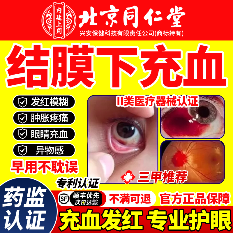 结膜下出血眼睛毛细血管破裂