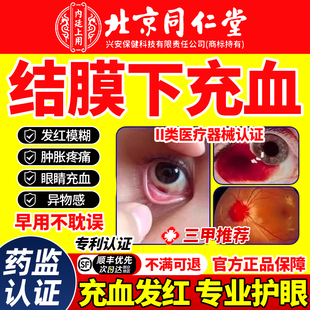 结膜下出血眼睛毛细血管破裂眼底充血专用叶黄素滴眼液官方旗舰店