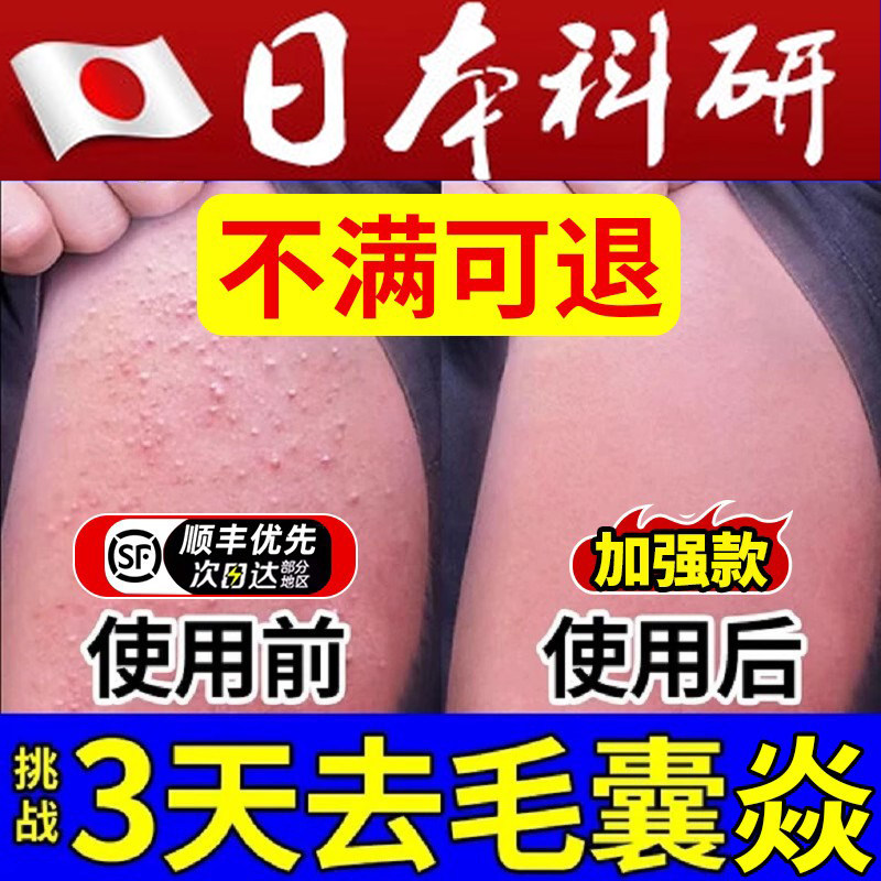 手臂毛囊炎专用脂溢性胳膊上长硬疙瘩药膏真菌感染鸡皮肤角化喷雾
