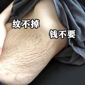 【屈臣氏推荐 去掉身上99%痕迹】身体不留一丝痕迹 不再尴尬
