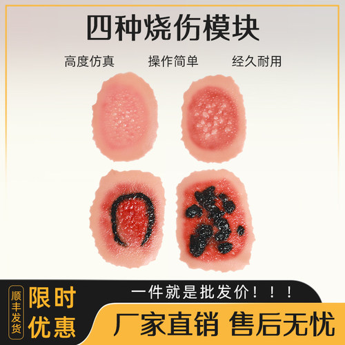 烧伤硅胶模块 博友教学模型1-4级程度贴式烧伤皮肤模型 医学