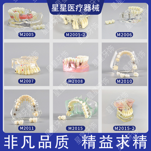 牙科口腔种植模型医患沟通系列模型可拆卸口腔教学模型水晶透明款