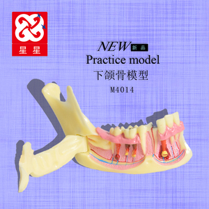 1/4 下颌骨龋坏模型 解剖模型 牙科病理展示模型 医患沟通模型