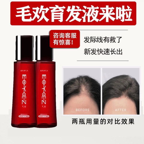 Япония импортировала маохуаньские волосы жидкие жидкие волосы стрижка волос и выпадение волос антидентные волосы плотные волосы плотные волосы Wu Xin и Cecilia Cheung Рекомендация