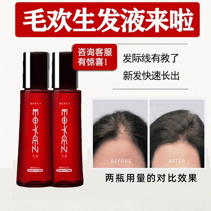 毛博仕日本进口毛欢生发液育毛防脱浓密增发剂155元