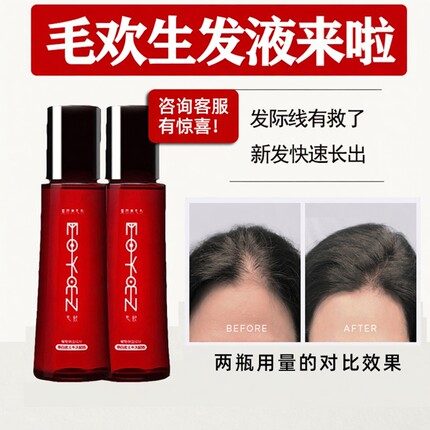 日本进口毛欢生发液 育毛剂防脱浓密增发神器 吴昕张柏芝推荐