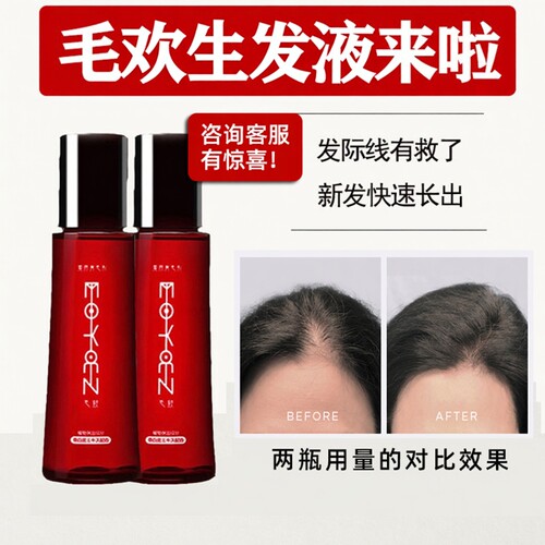 日本进口防脱浓密生发液