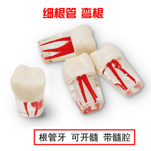 牙科口腔材料牙齿模型学模型开髓备洞根管练习牙医考试树脂牙粒