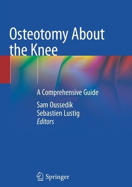 【预订】Osteotomy About the Knee 9783030490577