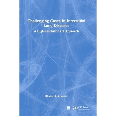 预订 Challenging Cases in Interstitial Lung Diseases: A High-Resolution CT Approach 间质性肺疾病的疑难病例:高分辨率CT方