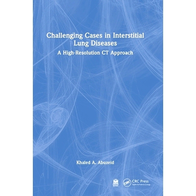 预订 Challenging Cases in Interstitial Lung Diseases: A High-Resolution CT Approach 间质性肺疾病的疑难病例：高分辨率CT方