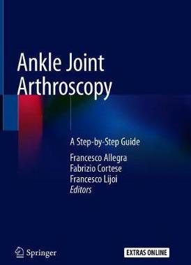 预订 Ankle Joint Arthroscopy