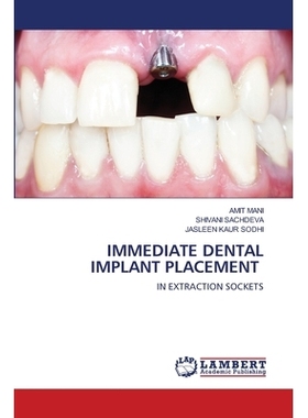 预订 Immediate Dental Implant Placement: 9786203202847