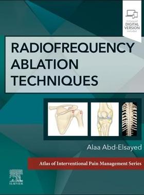 [预订]Radiofrequency Ablation Techniques 9780323870634