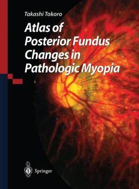 预订 Atlas of Posterior Fundus Changes in Pathologic Myopia