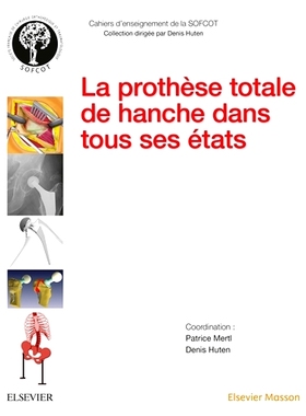预订 La prothèse totale de hanche dans tous ses états 各种形式的全髋关节假体: 9782294751165