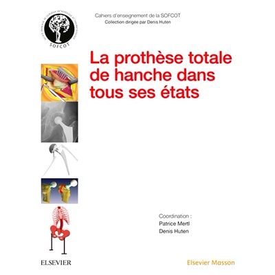 预订 La prothèse totale de hanche dans tous ses états 各种形式的全髋关节假体: 9782294751165