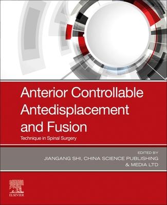 [预订]Anterior Controllable Antedisplacement and Fusion 9780323880497