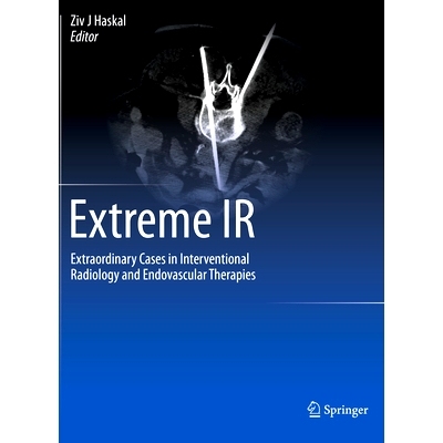 预订 Extreme IR: Extraordinary Cases in Interventional Radiology and Endovascular Therapies 极端的介入放射学：介入放射学