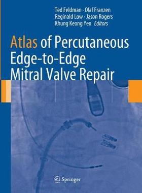 预订 Atlas of Percutaneous Edge-to-Edge Mitral Valve Repair