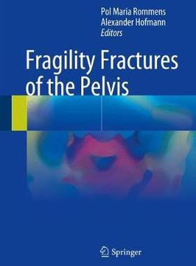 预订 Fragility Fractures of the Pelvis