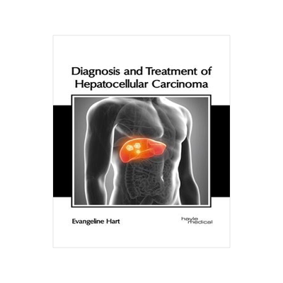 [预订]Diagnosis and Treatment of Hepatocellular Carcinoma 9781632418517