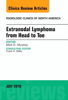 【预订】Extranodal Lymphoma from Head to Toe, An Issue of Radiologic Clinics of North America
