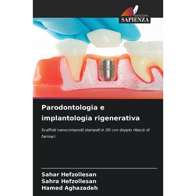 预订 Parodontologia e implantologia rigenerativa: Scaffold nanocompositi stampati in 3D con doppio rilascio di farmaci.