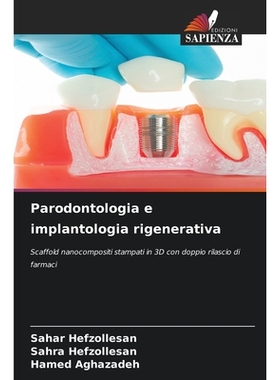 预订 Parodontologia e implantologia rigenerativa: Scaffold nanocompositi stampati in 3D con doppio rilascio di farmaci.