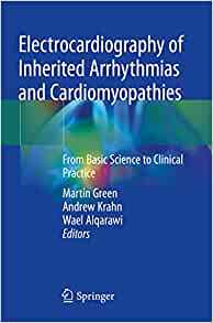 国外库房发货,通常付款后5-8周到货!