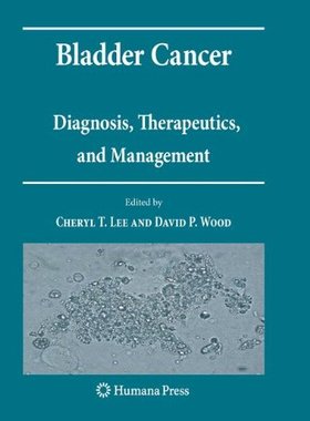 【预订】Bladder Cancer