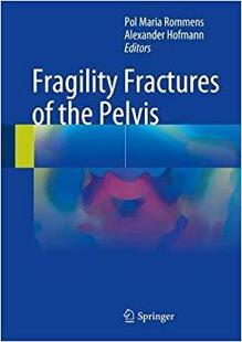 【预售】Fragility Fractures of the Pelvis