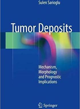 【预售】Tumor Deposits