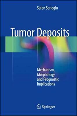 【预售】Tumor Deposits