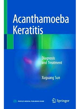 预订 Acanthamoeba Keratitis: Diagnosis and Treatment 棘阿米巴角膜炎：诊断与治疗: 9789811052118