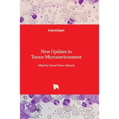 预订 New Updates in Tumor Microenvironment 肿瘤微环境的新进展: 9780854669417