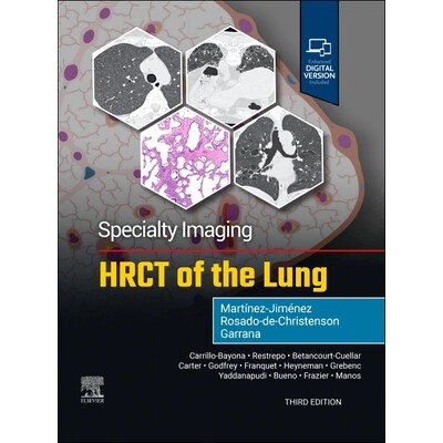 预订 Specialty Imaging HRCT of the Lung 专业影像:肺部高分辨率CT 9780443286360