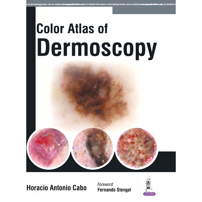 预订 Colour Atlas of Dermoscopy: 9789386056306