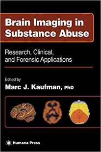 预订 Substance Brain Abuse Imaging