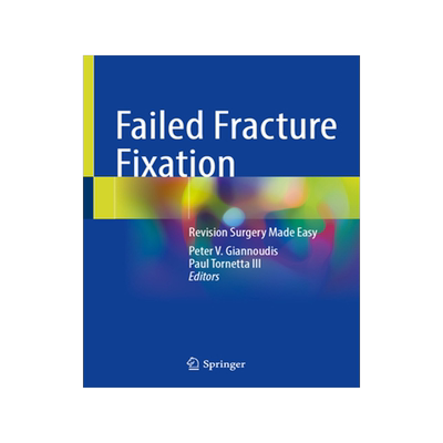 预订 Failed Fracture Fixation