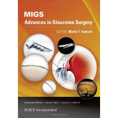 预订 MIGS Advances in Glaucoma Surgery MIGS：青光眼手术的进展 9781617116001