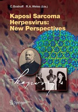 【预订】Kaposi Sarcoma Herpesvirus: New Perspectives