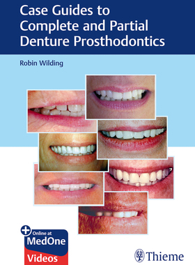 【预订】Case Guides to Complete and Partial Denture Prosthodontics