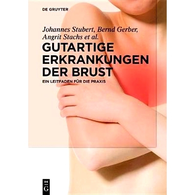 预订 Gutartige Erkrankungen der Brust: Ein Leitfaden für die Praxis 良性乳房疾病: 9783110609813