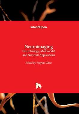 [预订]Neuroimaging - Neurobiology, Multimodal and Network Applications 9781789844306