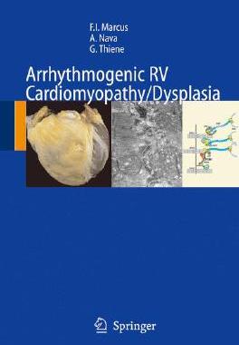 【预订】Arrhythmogenic RV Cardiomyopathy/Dysplasia