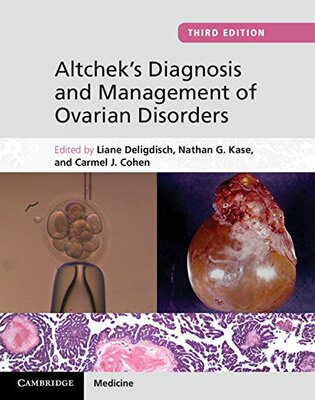 【预订】Altchek’s Diagnosis and Management of Ovarian Disorders