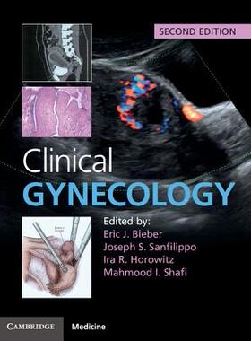 【预订】Clinical Gynecology