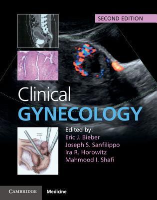 【预订】Clinical Gynecology