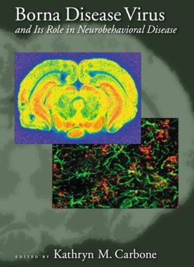 【预订】Borna Disease Virus and its Role in Neurobehavioral Diseases